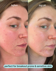 calming magnesium mist
